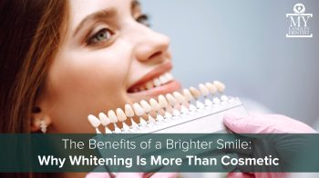 Discover how professional teeth whitening at My Langley Dentist in Langley boosts confidence and improves your oral health; it’s more than just cosmetic.
