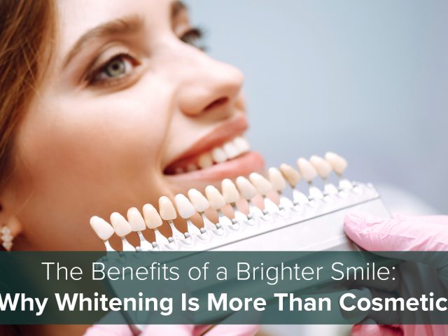 The Benefits of a Brighter Smile: Why Whitening Is More Than Cosmetic (featured image)